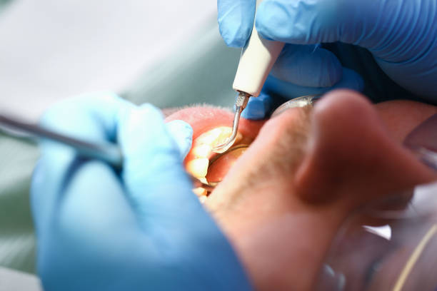 Best Tooth Infection Emergency Dentist  in Columbus, NC